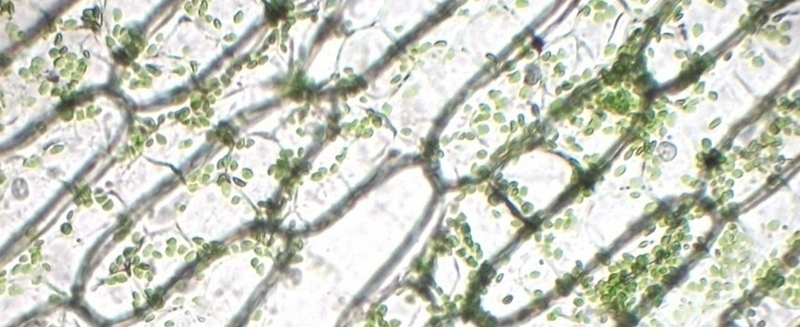 Microscope image of plant cells.