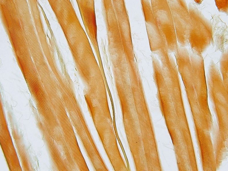Microscope image of muscle tissue fibres.