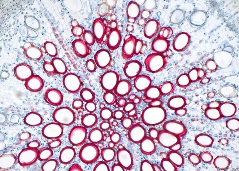 Microscopic image of vascular tissue.
