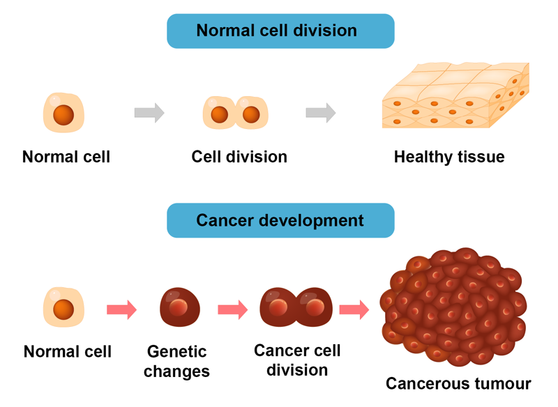 A comparison between normal cell division and cancer development. In normal cell division, a cell divides without complications, resulting in healthy tissue. In cancer, a normal cell undergoes genetic chances during division, resulting in uncontrolled (cancerous) cell division and the formation of a cancerous tumour.