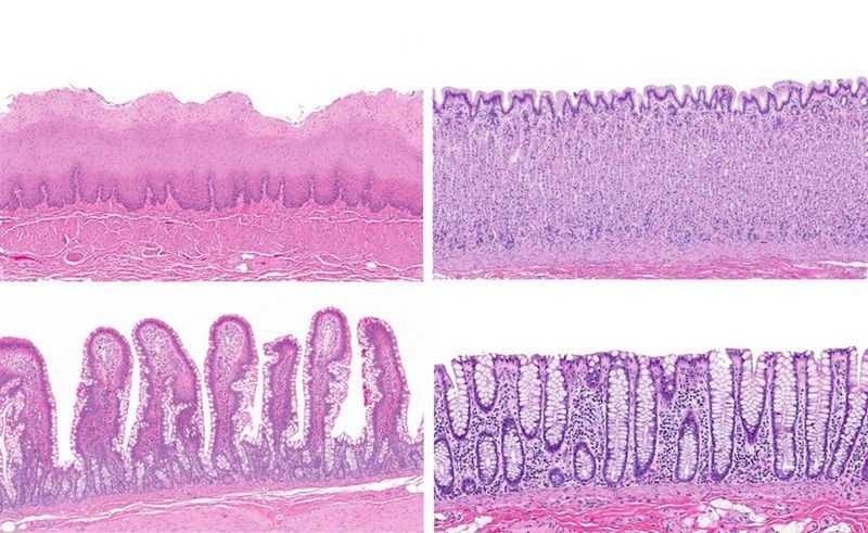 Different epithelial tissues viewed through a microscope. The tissues in the image are from the esophagus (upper left corner), stomach (upper right corner), small intestine (lower left) and large intestine (lower right). Compare the surface structures of the tissues.