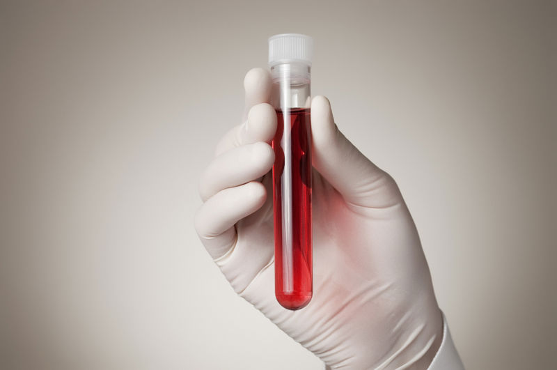Photo of a gloved hand holding a test tube of blood.